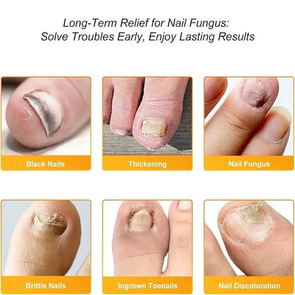 FungalPatch - Antybakteryjna Plaster na Grzybicę i Pielęgnacja Paznokci